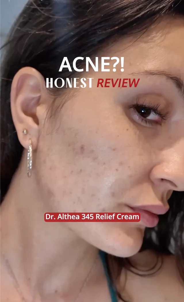 345 Relief Cream